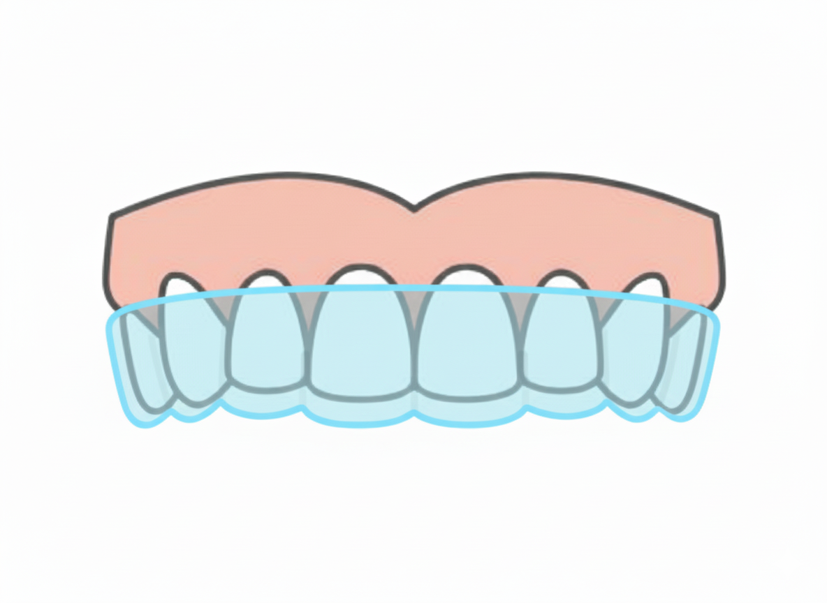 clear aligner blue Gemini Generated Image 6cw2kq6cw2kq6cw2 All Maple Ridge Locals